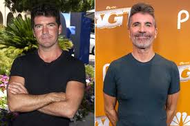 Simon Cowell’s Plastic Surgery: Everything the Music Mogul Has Revealed About His Cosmetic Proced…