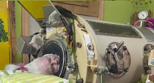 Last American polio survivor in an iron lung dies at 78 | Martha Lillard, last American using iro…