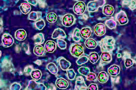 Two people in Pennsylvania have died from measles | Pennsylvania reports first 2 measles deaths i…